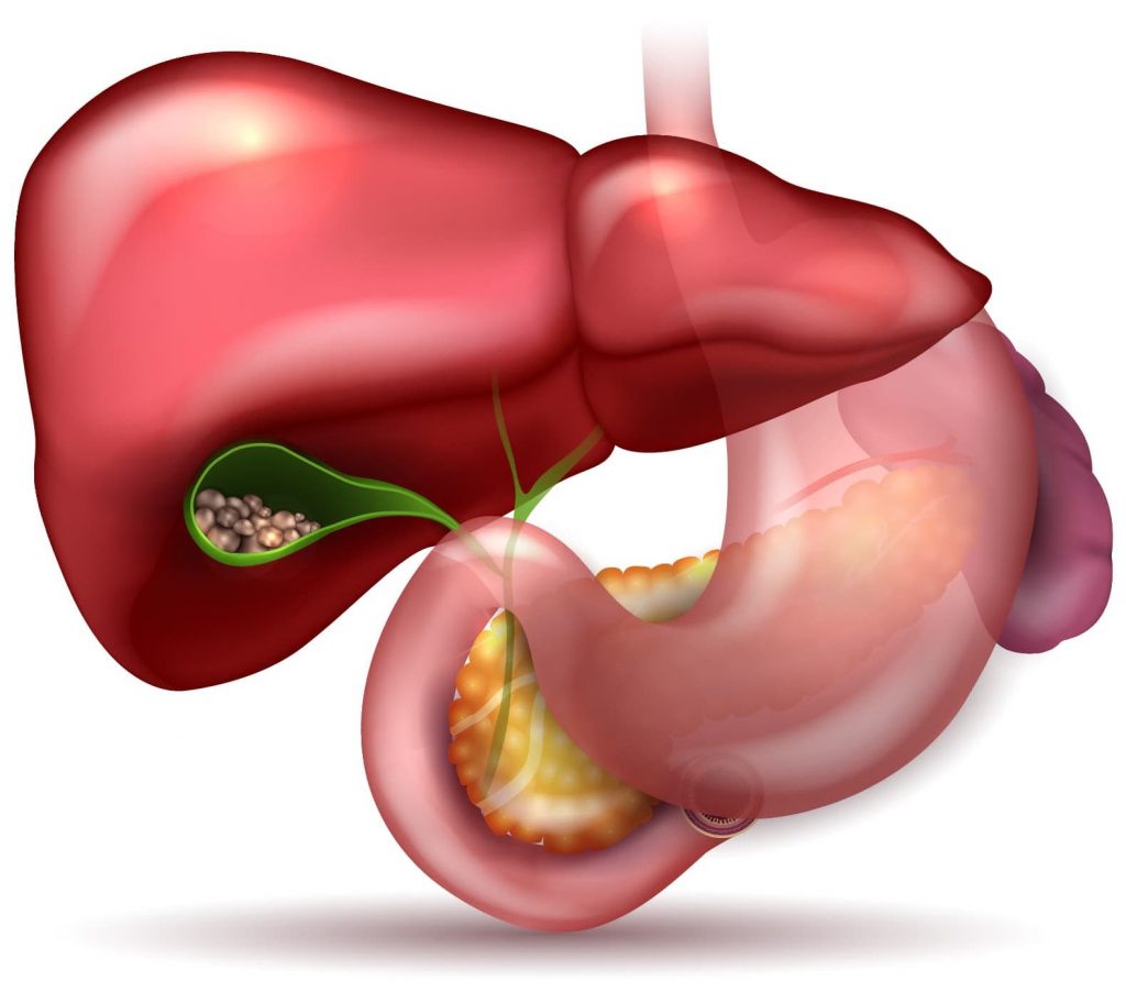 Safra Kesesi Hastalıkları: